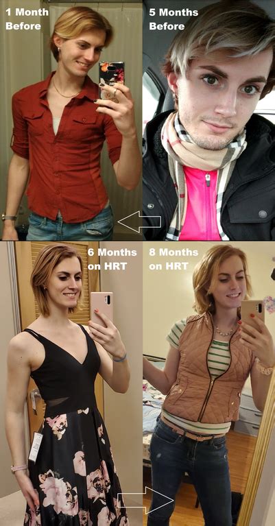 Success Stories of MTF Magic Transformation: Inspiring Others to Dream Big